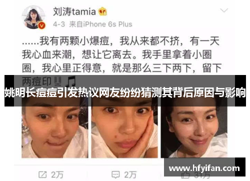 姚明长痘痘引发热议网友纷纷猜测其背后原因与影响