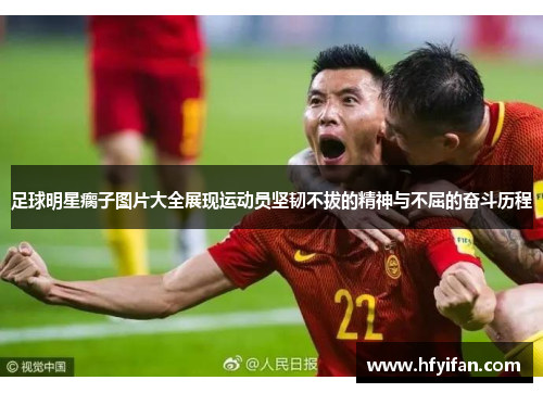 足球明星瘸子图片大全展现运动员坚韧不拔的精神与不屈的奋斗历程